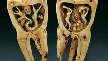 افسانه کرم دندان از چه دورانی آغاز شد؟
