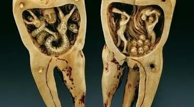 افسانه کرم دندان از چه دورانی آغاز شد؟
