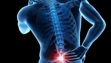 کدام کمردردها باید جراحی شوند؟