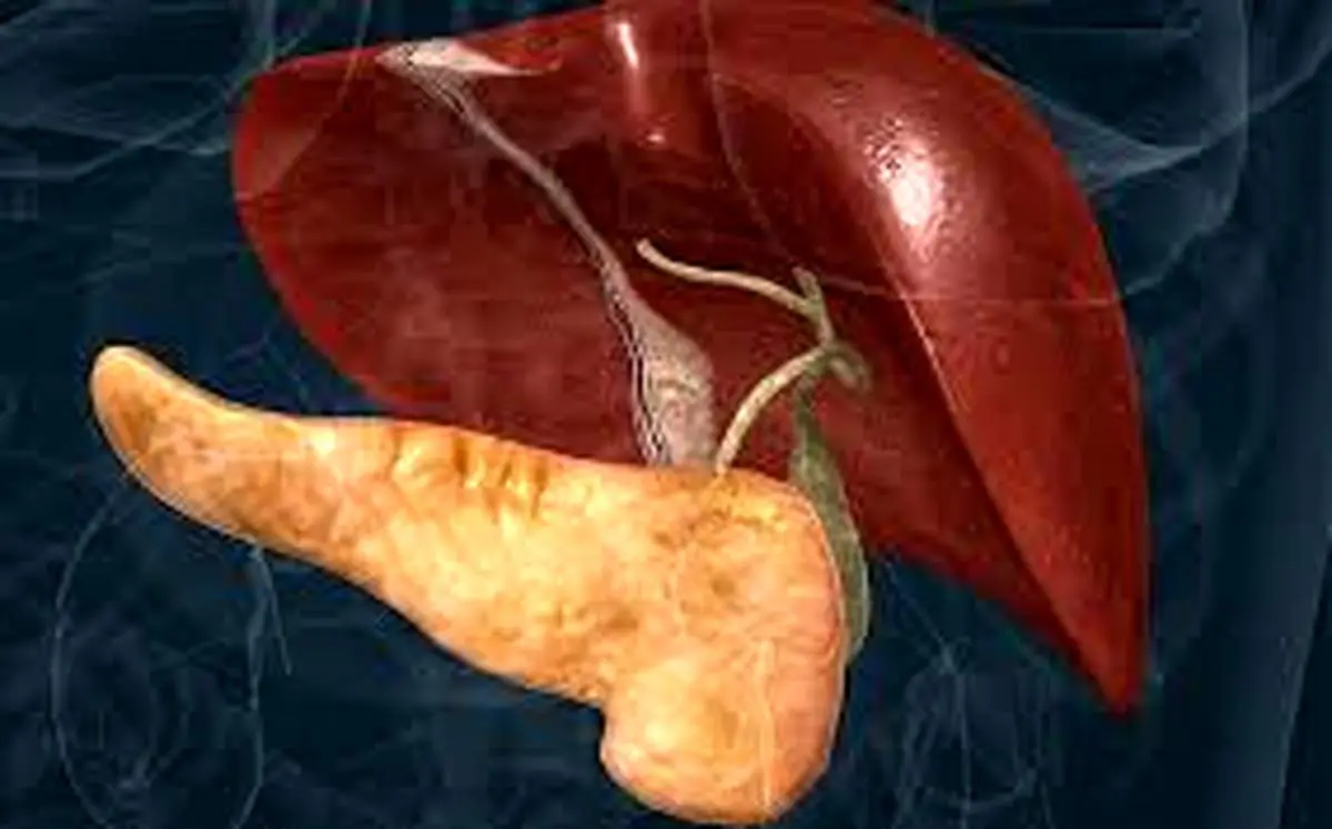  ۵ درمان خانگی کبد گرید ۳