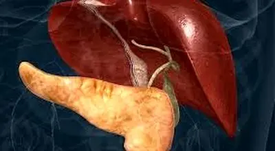  ۵ درمان خانگی کبد گرید ۳