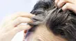 علت سفیدی مو از نظر طب سنتی چیست؟

