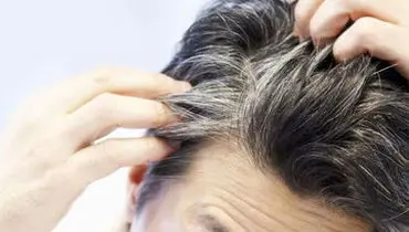 علت سفیدی مو از نظر طب سنتی چیست؟
