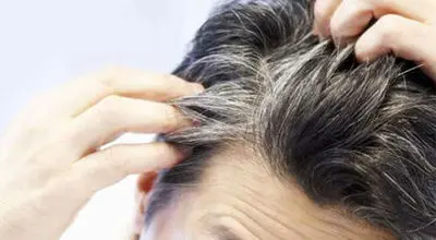 علت سفیدی مو از نظر طب سنتی چیست؟

