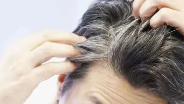 علت سفیدی مو از نظر طب سنتی چیست؟
