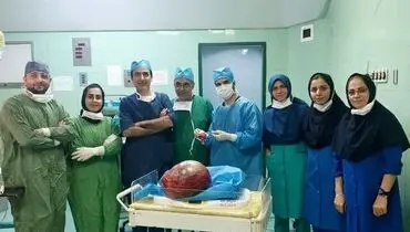 خارج کردن توده ۶ کیلویی از شکم یک زن آملی+ فیلم