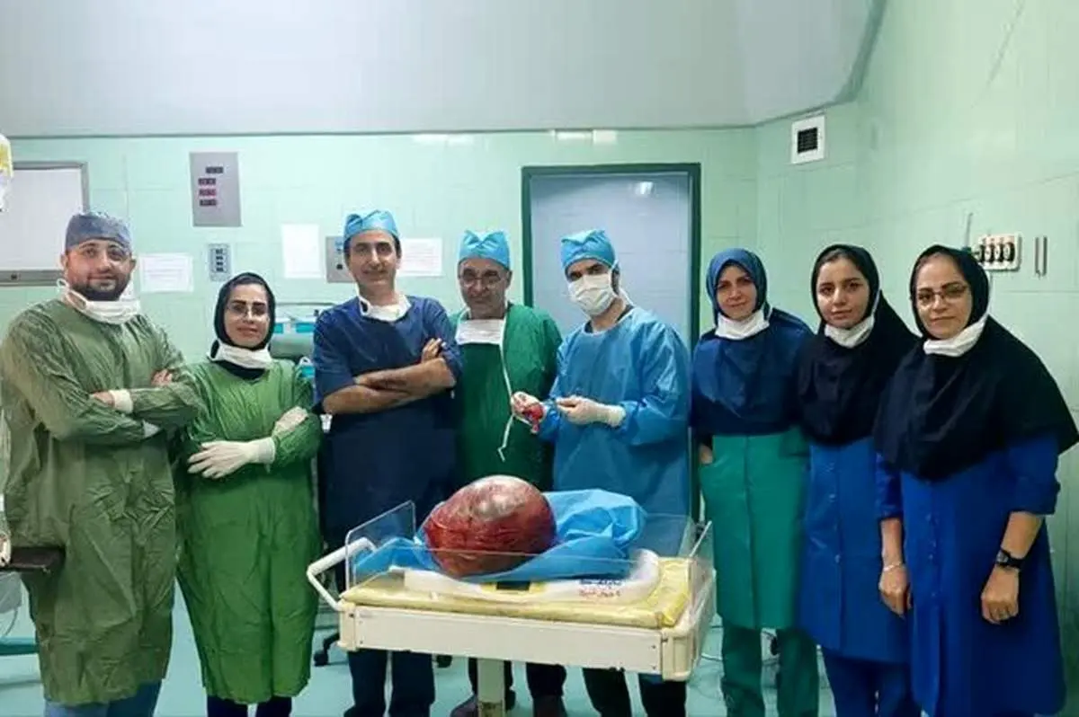 خارج کردن توده ۶ کیلویی از شکم یک زن آملی+ فیلم