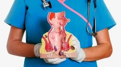 داروهای موقتی و درمان فوری بواسیر