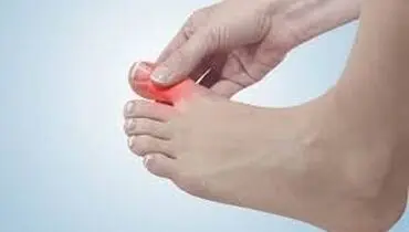 علت ابتلای  انگشتان پا به التهاب مفصلی چیست؟