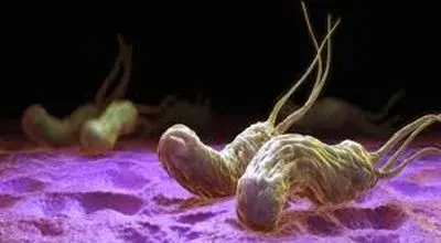 
میکروب معده چیست و چگونه از بین می رود؟ 
