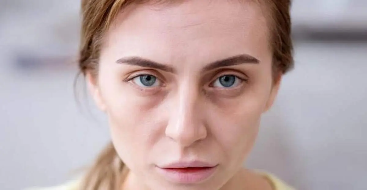 ۷ نشانه‌ پوستی که بیماری جدی را آشکار می‌کنند

