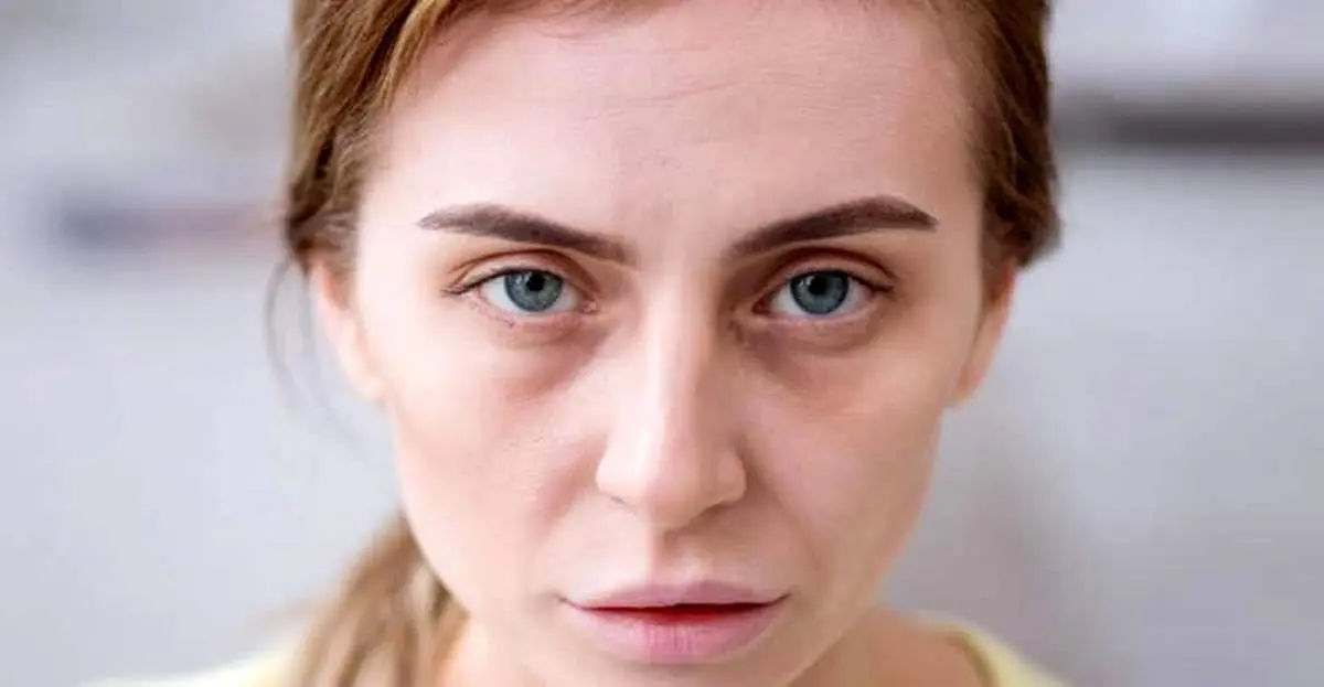 ۷ نشانه‌ پوستی که بیماری جدی را آشکار می‌کنند
