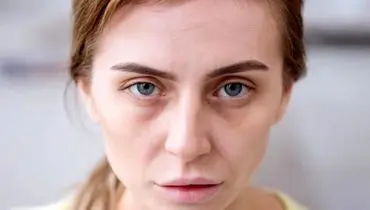 ۷ نشانه‌ پوستی که بیماری جدی را آشکار می‌کنند
