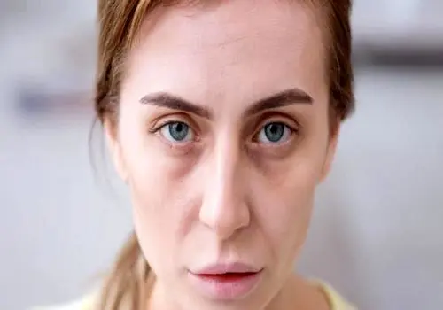 ۷ نشانه‌ پوستی که بیماری جدی را آشکار می‌کنند
