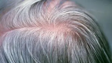 آیا می‌توان جلوی سفید شدن موها را گرفت؟