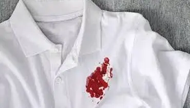 چگونه لکه خون روی حوله را به راحتی پاک کنیم؟
