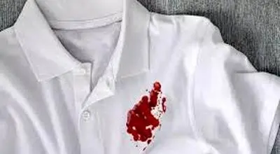 چگونه لکه خون روی حوله را به راحتی پاک کنیم؟
