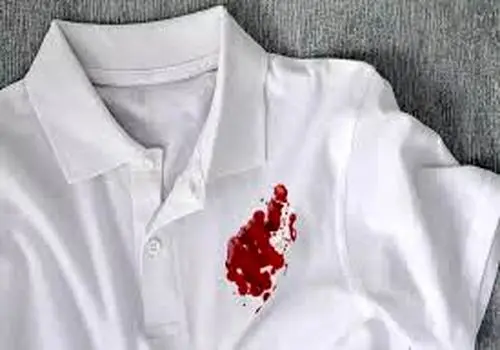 چگونه لکه خون روی حوله را به راحتی پاک کنیم؟
