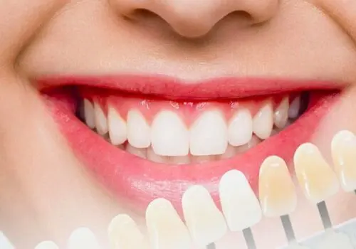 روشی نوین برای بازیابی مینای دندان بدون پرکردن