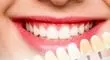 رازی که رنگ دندان فاش میکند؛ خطرناک ترین لکه چه رنگی است؟