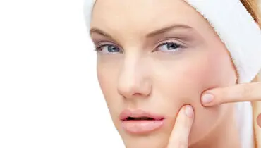 چکار کنیم جوش نزنیم؟