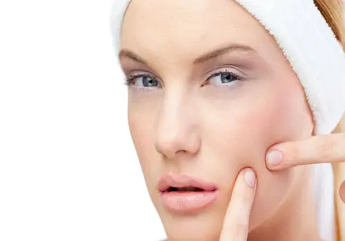 چطور از جوش پیشانی جلوگیری کنیم؟
