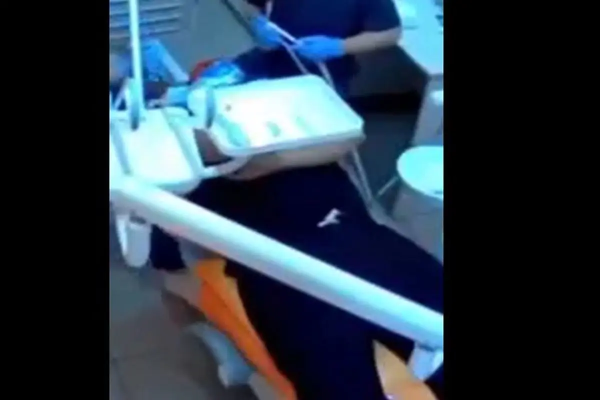 انفجار دستگاه دندان پزشکی در دهان بیمار + فیلم