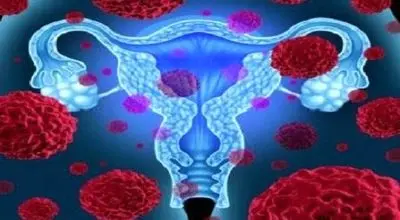 دانستنی هایی درباره فیبروم رحمی
