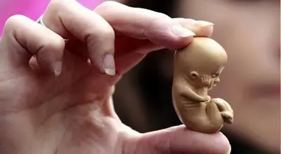 عوارض سقط‌های غیرقانونی را جدی بگیرید