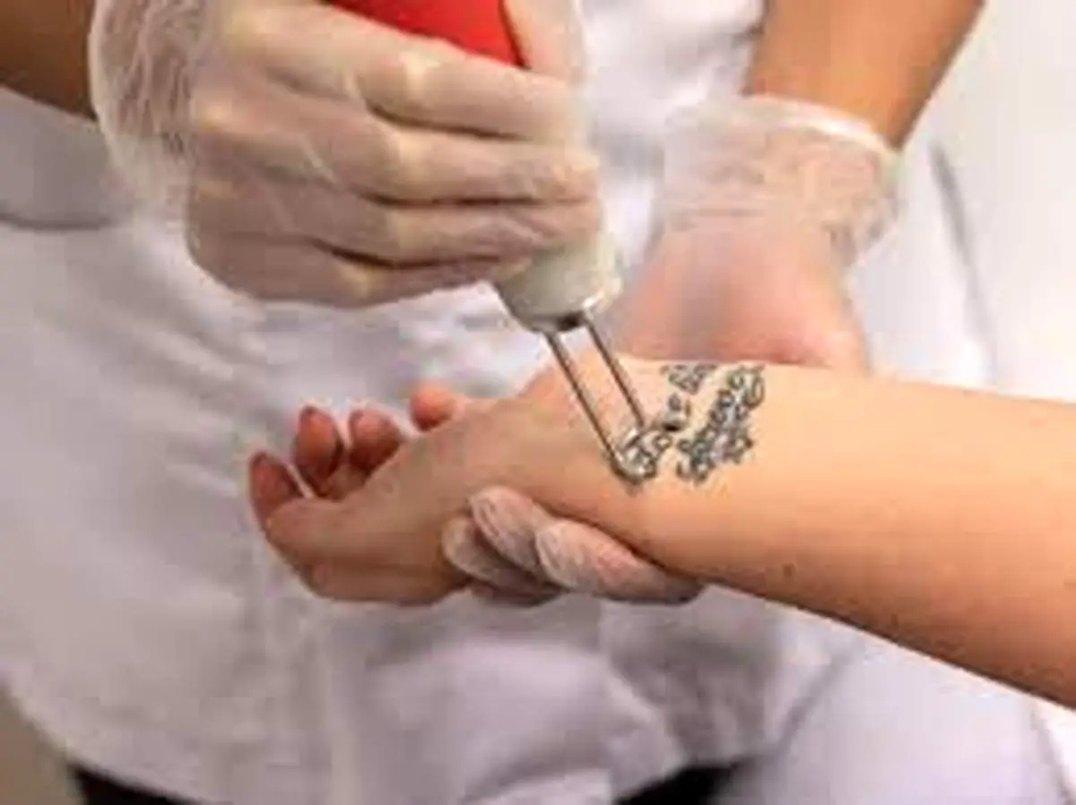 راه پاک کردن خالکوبی و تاتو در خانه چیست؟
