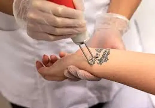 چگونه چشم هایمان را در خانه معاینه کنیم ؟
