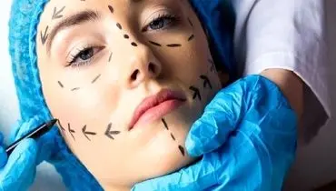 پشت پرده تلخِ زیبایی در ایران



