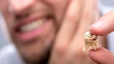 دندان‌پزشکان هشدار می‌دهند: پنج اشتباه رایج در مراقبت از دندان‌ها