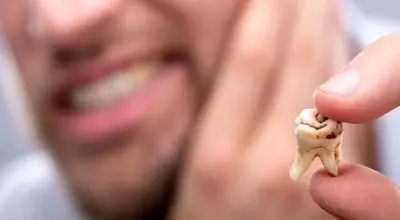 دندان‌پزشکان هشدار می‌دهند: پنج اشتباه رایج در مراقبت از دندان‌ها