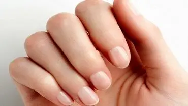 تغییر رنگ ناخن به قهوه ای یا زرد خطرناک است؟