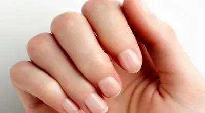 تغییر رنگ ناخن به قهوه ای یا زرد خطرناک است؟