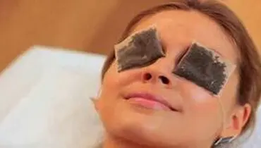  شستن چشم با چای علمی است؟