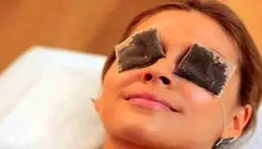  شستن چشم با چای علمی است؟