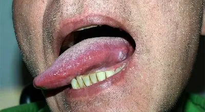 این علامت را روی زبان خود دیدید، نگران شوید!
