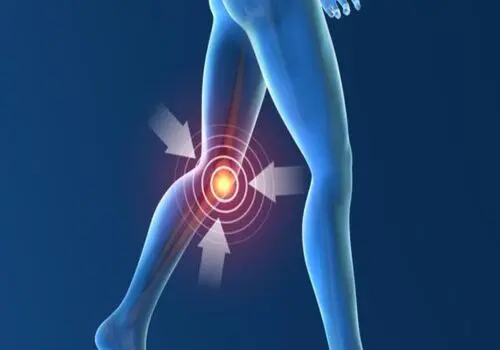 چگونه رژیم غذایی می‌تواند به مدیریت آرتروز کمک کند؟