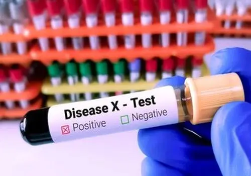 مرگ ۵ نفر در پی شیوع بیماری جدید در اروپا، هر آنچه باید در مورد تب طوطی بدانید