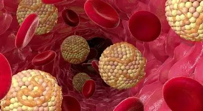 پشت پرده اطلاعات غلط درباره کلسترول بد