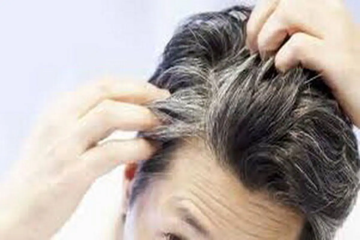 13 راهکار ساده برای از بین بردن چربی موی سر