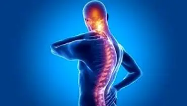 علائم و درمان روماتیسم ستون فقرات یا آرتریت روماتوئید