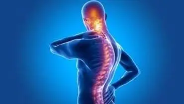 علائم و درمان روماتیسم ستون فقرات یا آرتریت روماتوئید
