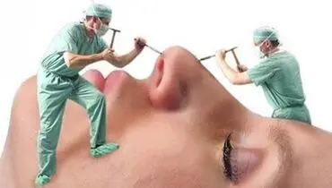 چهره ای را که خدا خلق کرده، با کدام دلیل و منطق به تیغ جراحان می سپاریم؟