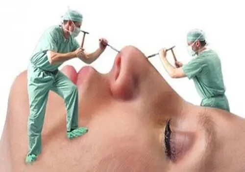 چه کسانی نباید بوتاکس تزریق کنند؟