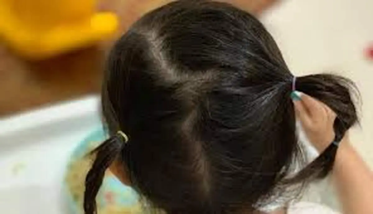  دلایل سفید شدن مو در کودکان