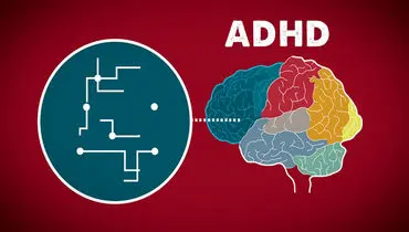 نحوه انجام تست ADHD+فیلم