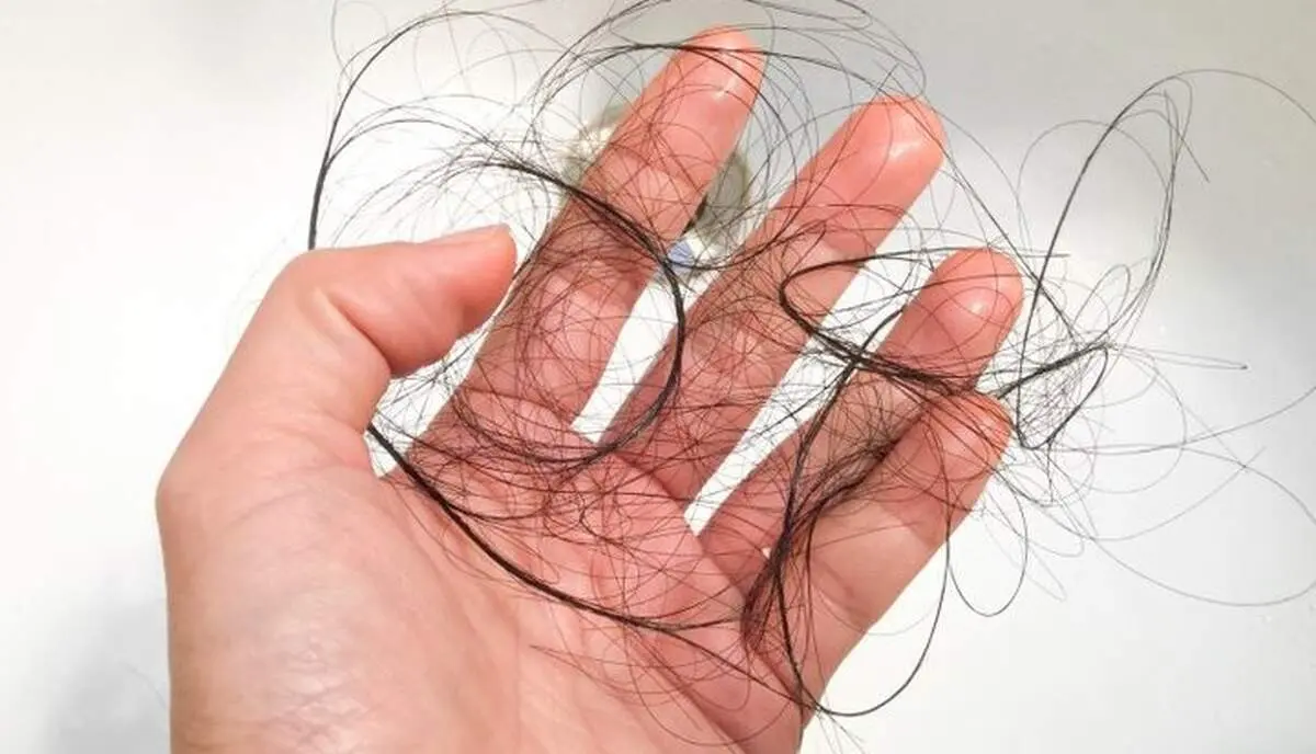 اگر ریزش مو دارید حتما بخوانید!